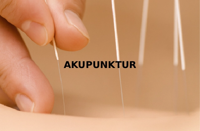 Akupunktur