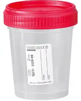 steriler-urin-schraubbecher-150-ml
