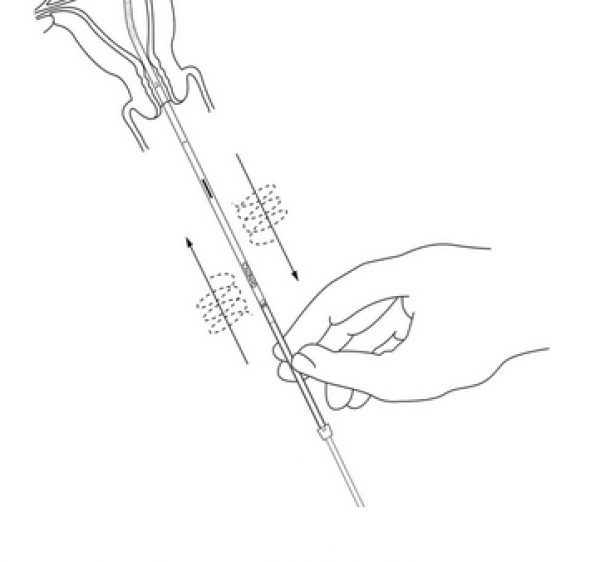 gynemed-probet-biopsie-saugkurette-ia